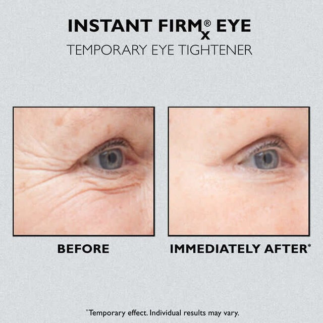 FirmX Eye Tightener